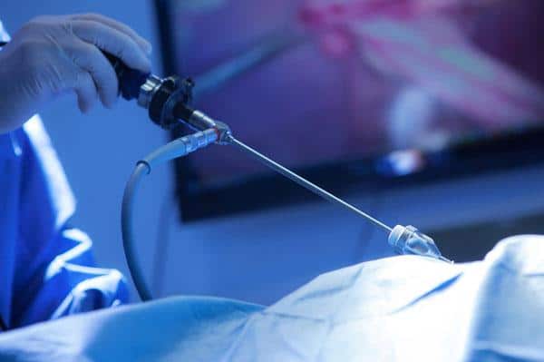 Surgeon holding a laparoscope and undertaking a laparoscopic hernia repair