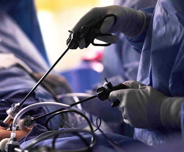 Laparoscopic surgery to repair recurrent inguinal hernia